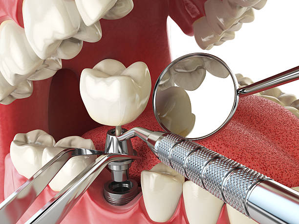 Best Urgent Tooth Repair  in Machias, WA
